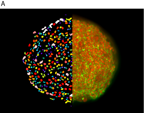 Imaging 3d cancer spheroids