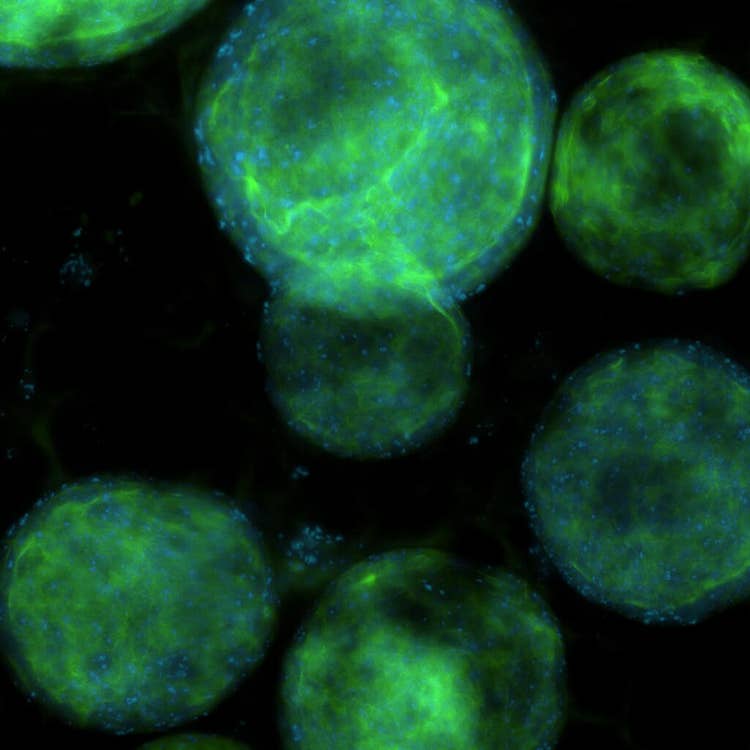 Lung Organoids C2