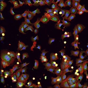 Cells treated with rotenone