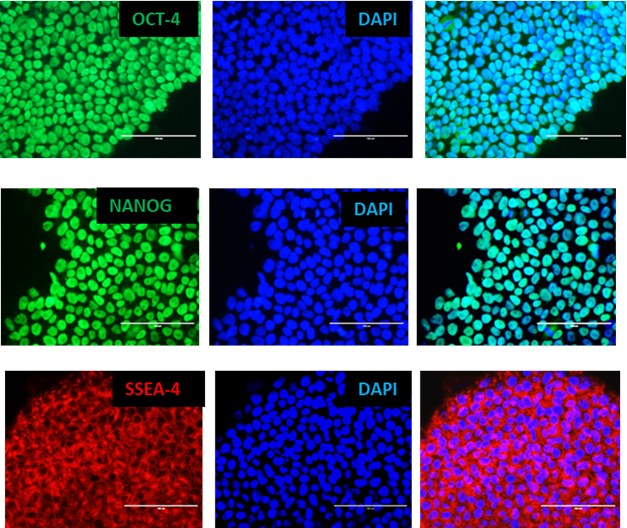 Pluripotent iPS Cells Express Pluripotency Markers - Oct-4,Nanog and SSEA4