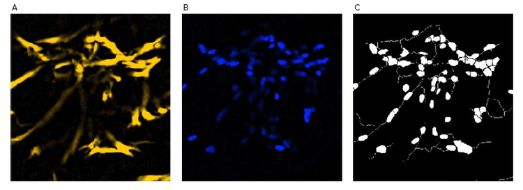 Examples of neurite outgrowth analysis