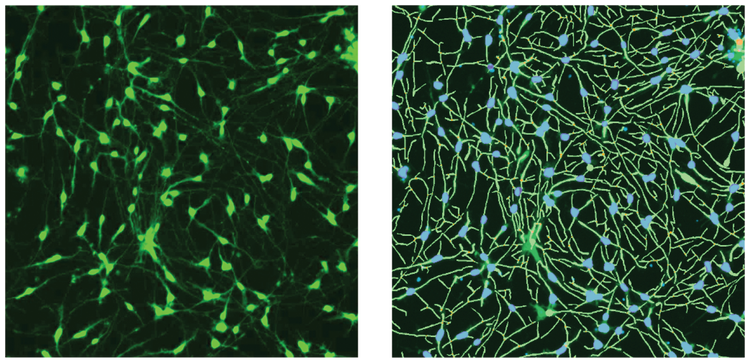 ß-tubulin (green) stain and the software analysis