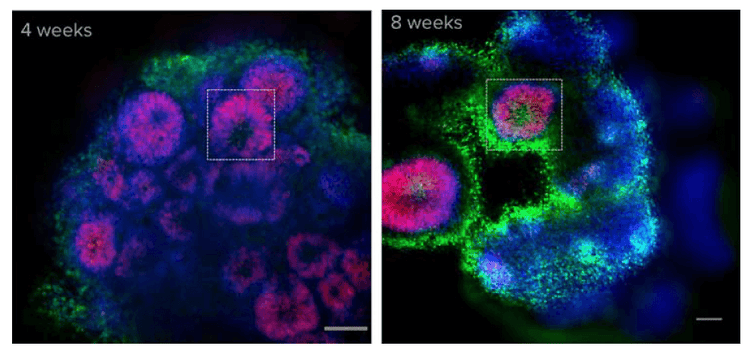 Cerebral organoids show organization reminiscent of a developing brain