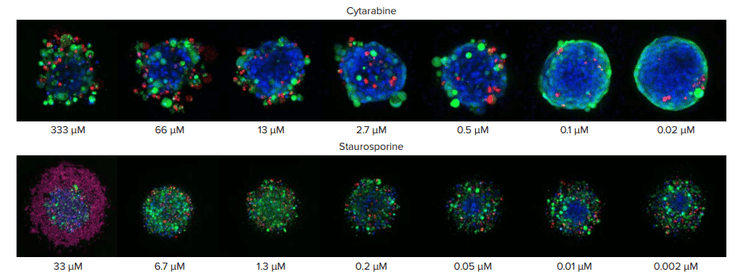 Spheroids treated with different concentrations of cytarabine and staurospoine