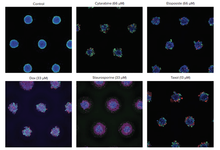 Representative images of control vs. treated spheroids