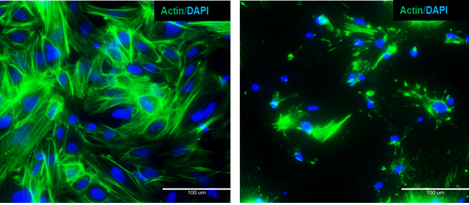 Cytoskeleton disruption- iPSC-derived Hepatocytes with Actin Stain for Untreated and Latrunculin-treated Cells