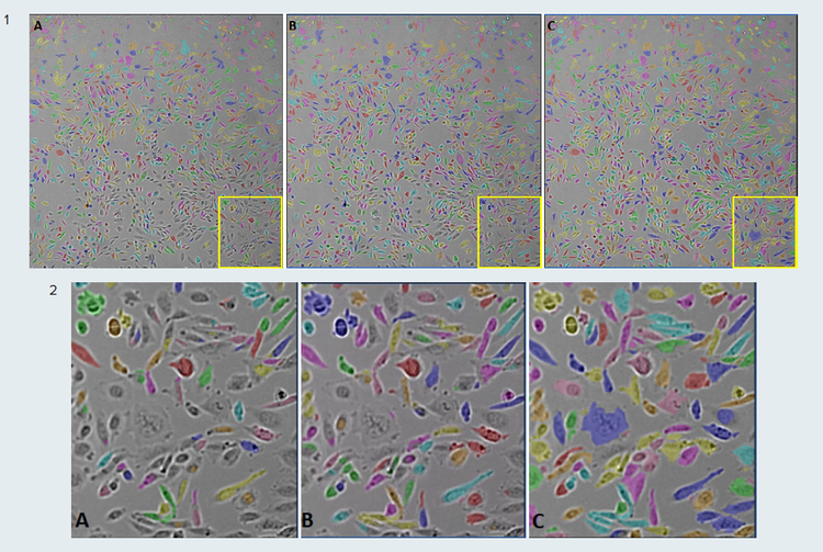 SINAP model fine-tuning