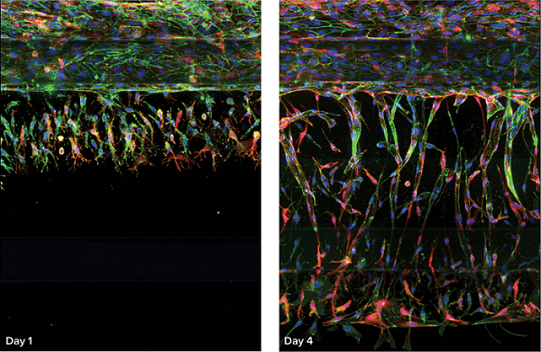 Angiogenic Sprouts in OrganoPlate