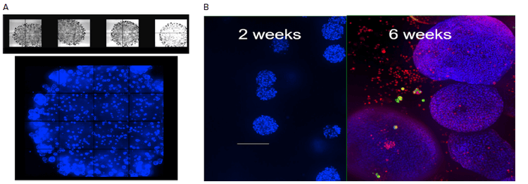 Organoids in Matrigel dome four weeks in culture and Comparison of organoid size