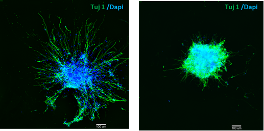 neurite outgrowth assay