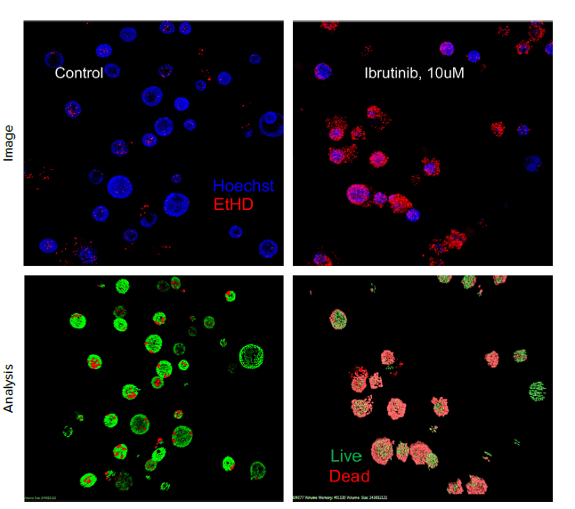 organoids were treated with different concentrations of Ibrutinib for 72 h