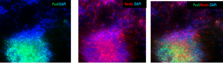 iPSCs-derived Neural Progenitor Cells Express Neural Progenitor Markers PAX6 and Nestin